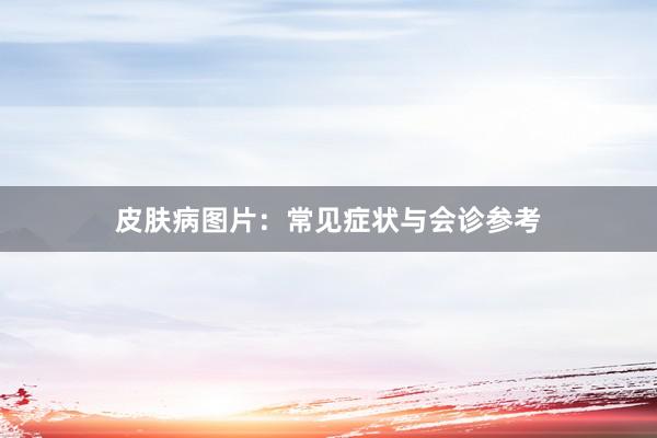 皮肤病图片：常见症状与会诊参考